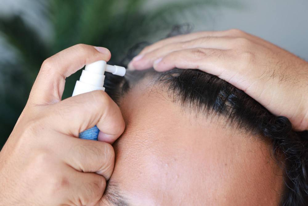 ยาแก้ผมร่วงแบบไหนเหมาะกับคุณ ระหว่าง Finasteride Dutasteride และ Minoxidil