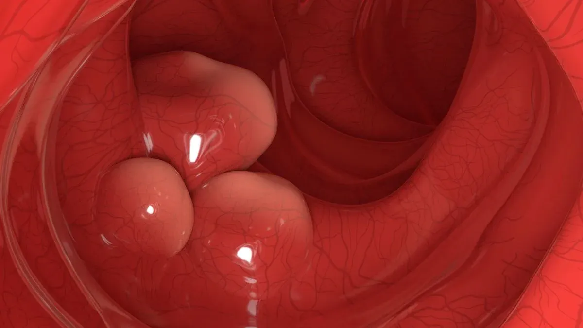 ไขรหัสความล่องหนของมะเร็ง เทคโนโลยี immunotherapy ยุคใหม่กำลังเปลี่ยนเกม