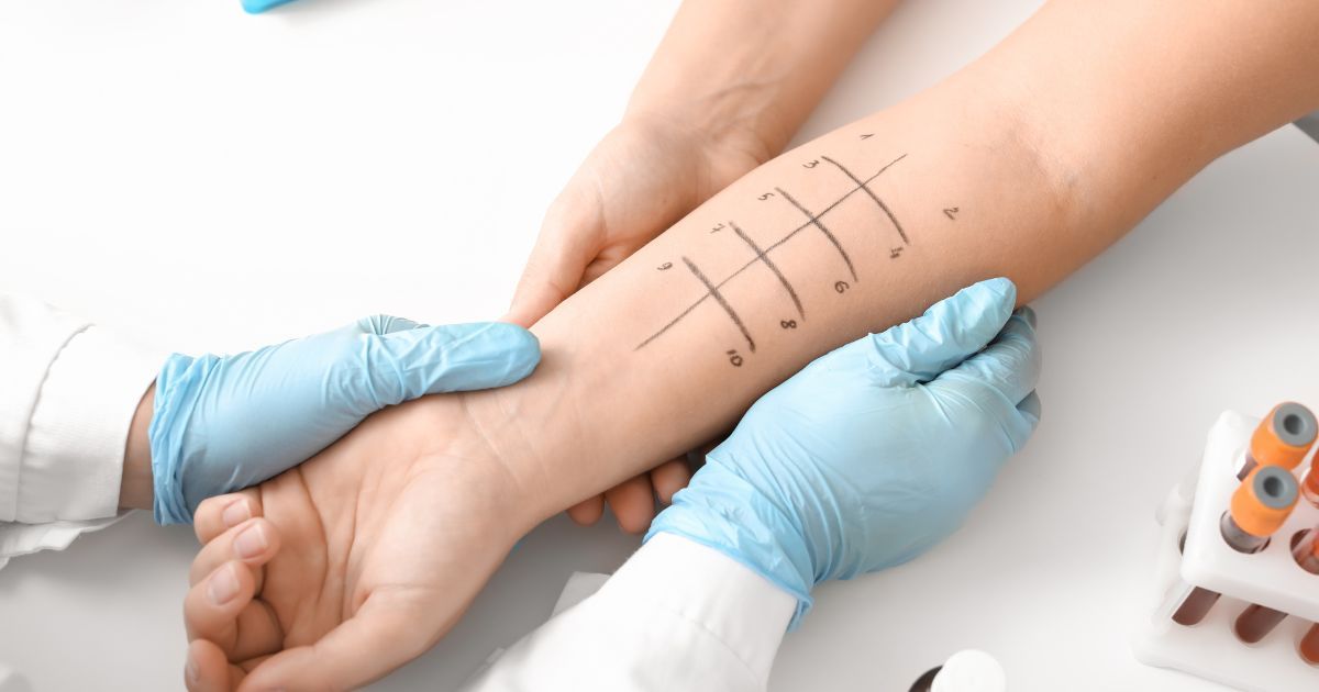 Patch Test สกินแคร์อย่างปลอดภัย คู่มือสำหรับผิวแพ้ง่าย