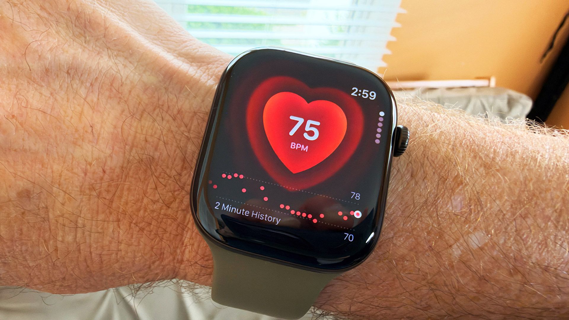 อธิบายฟีเจอร์สุขภาพของ Apple Watch Series 12 แบบเข้าใจง่าย