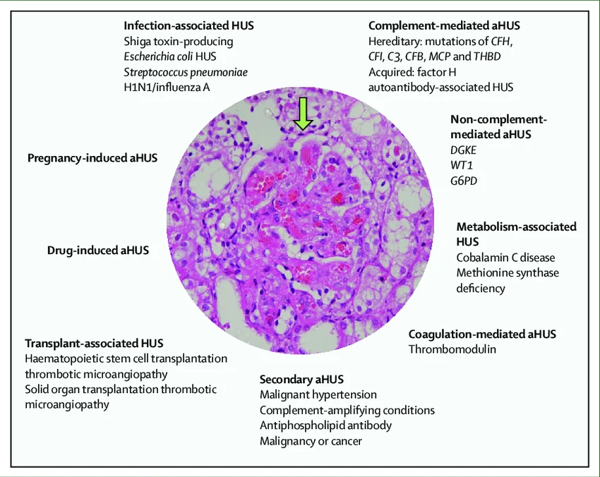 โรคหายาก aHUS ในเด็ก เวลาไม่ใช่แค่ตัวเลขแต่คือชีวิต