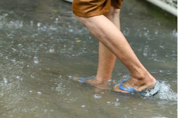 5 โรคช่วงฝนจากน้ำท่วม รู้ทันอาการเตือนภัยก่อนป่วยหนัก