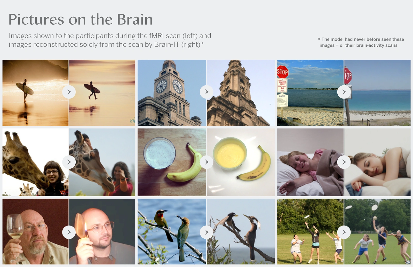 AI สร้างภาพจากสมองด้วย Brain-IT เปลี่ยนการสแกน MRI ให้กลายเป็นภาพ