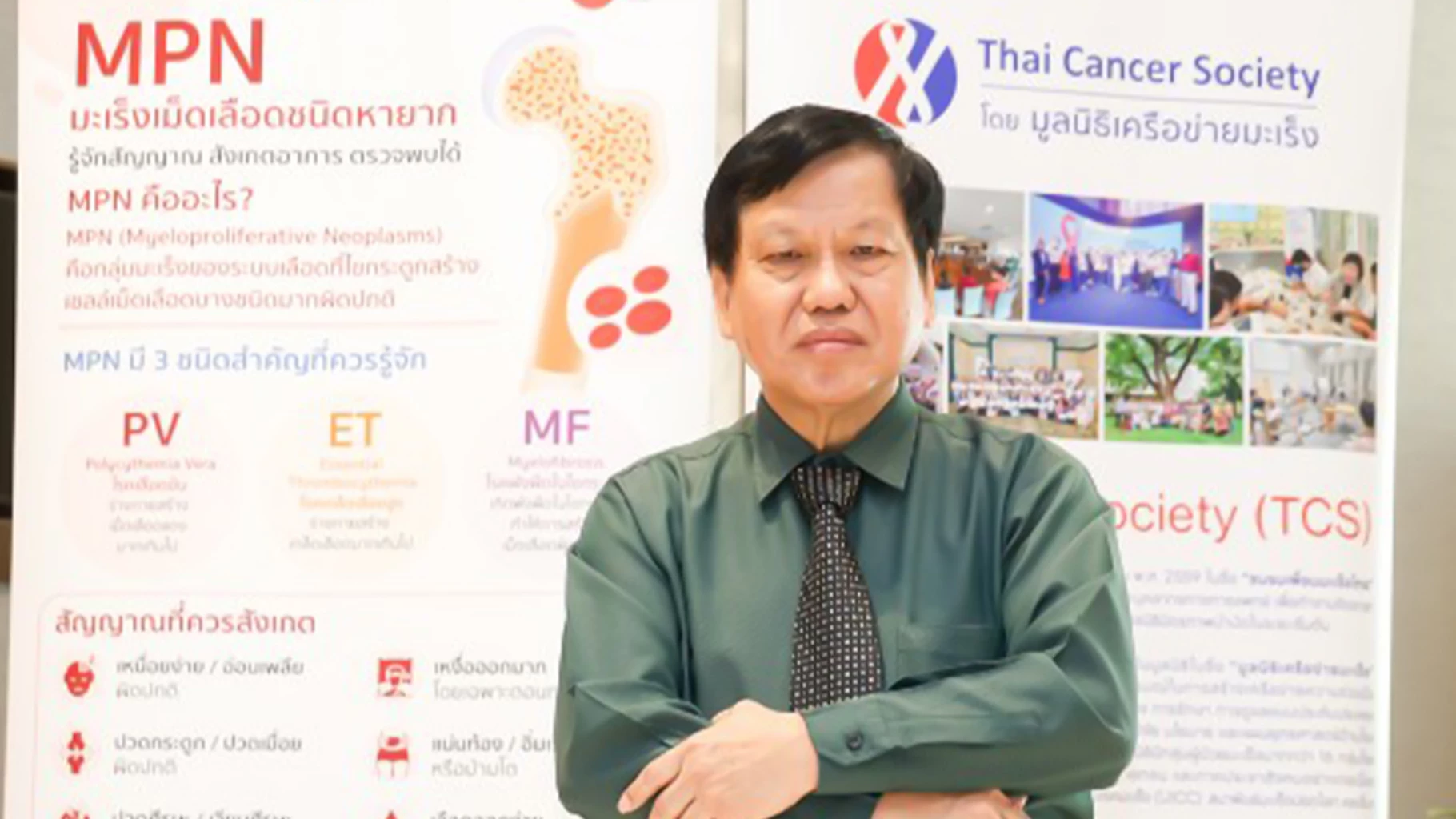 3 อาการเล็กที่ไม่เล็ก เหนื่อย ซีด แน่นท้อง สัญญาณเตือนโรค MF มะเร็งโลหิตหายาก