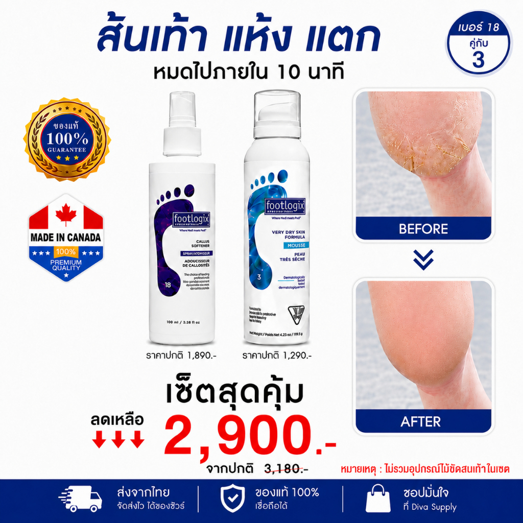 ราคาลดลงใหม่: Footlogix ชุดสปาเท้า