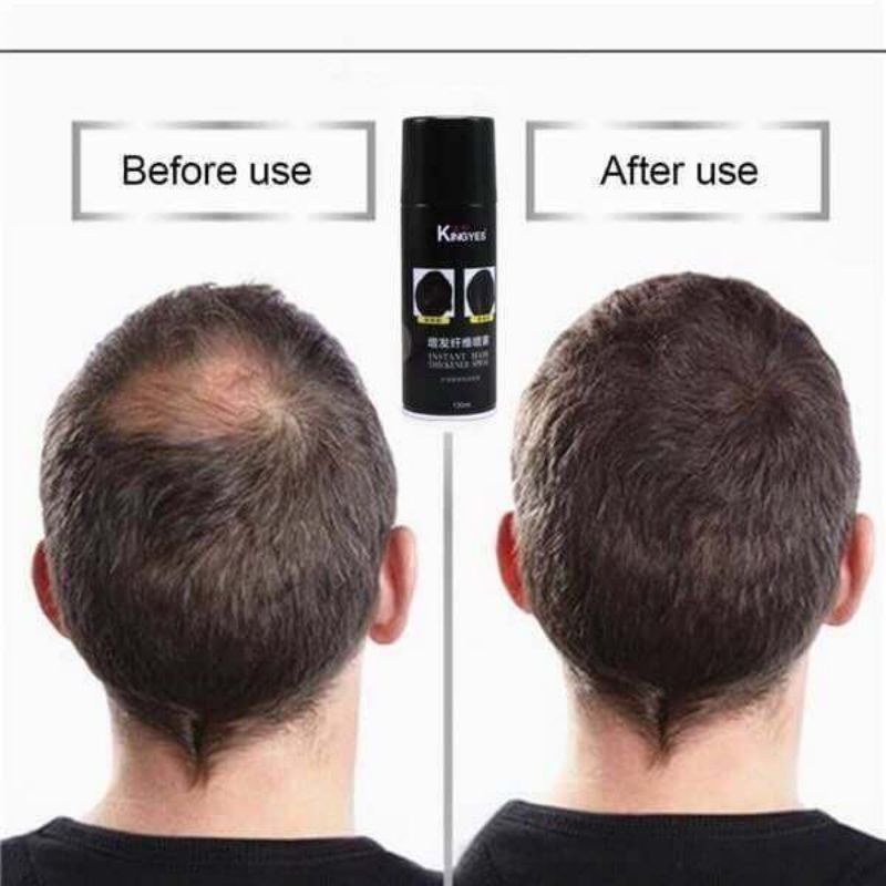 ราคาลดลงใหม่: **พร้อมส่ง**kingyes hair