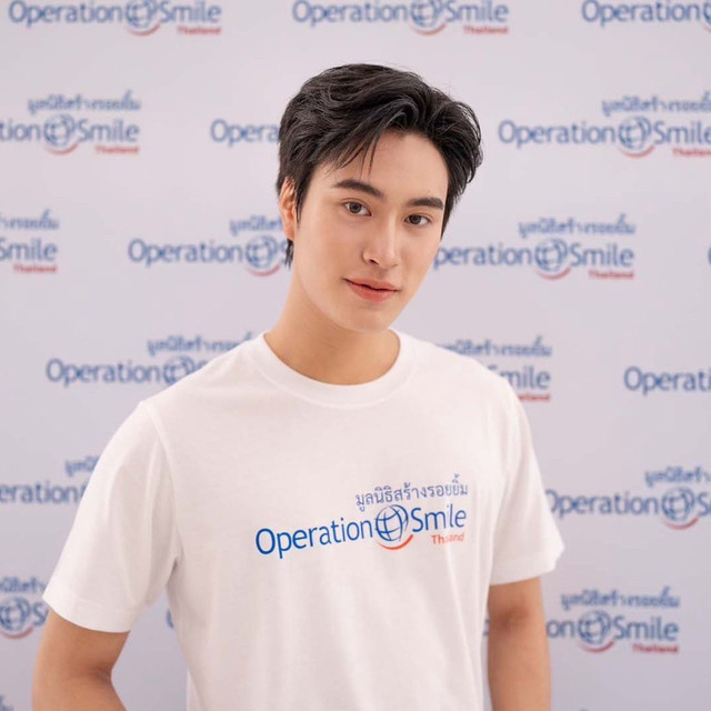 เจมีไนน์ นรวิชญ์ ชวนคืนรอยยิ้มผู้ป่วยไฟไหม้กับ Operation Smile