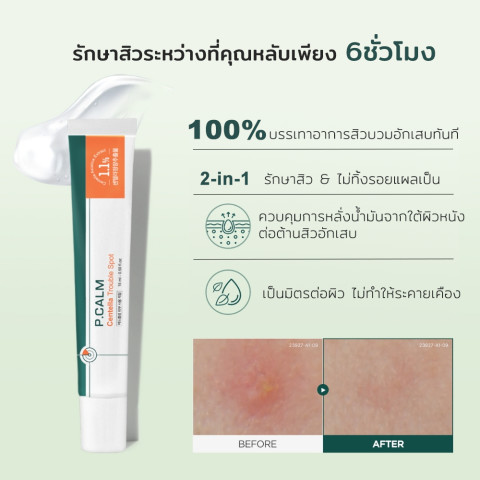 [P.CALM] ชุดรักษาสิวเข้มข้น 2 IN 1 Barrier Cycle Toner PAD 160ml +  Centella Soothing Gel 15ml Image5