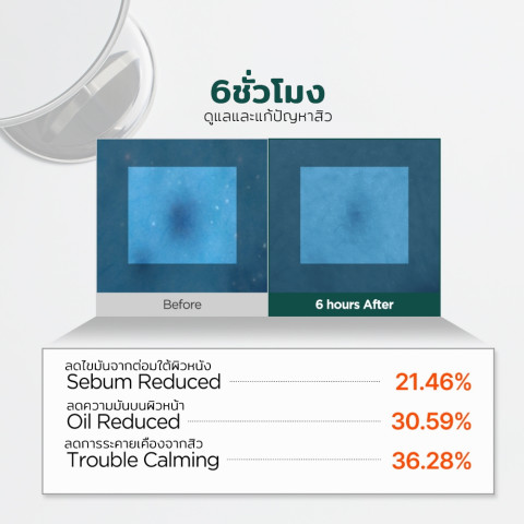 [P.CALM] ชุดรักษาสิวเข้มข้น 2 IN 1 Barrier Cycle Toner PAD 160ml +  Centella Soothing Gel 15ml Image6