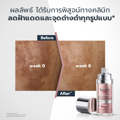 Eucerin SPOTLESS BRIGHTENING THIAMIDOL BOOSTER SERUM 30 ML เซรั่มจัดการฝ้าแดด กระ จุดด่างดำแก้ยาก Image4
