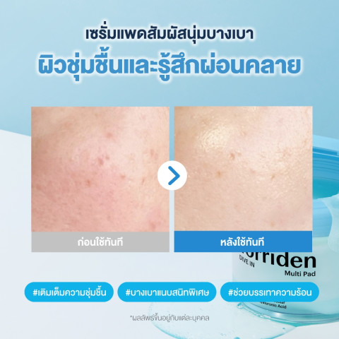Torriden Dive-In Low Molecular Hyaluronic Acid Multi Pad (80 แผ่น) ทอร์ริเดน โทนเนอร์แพด ไฮยาลูโรนิก Image4