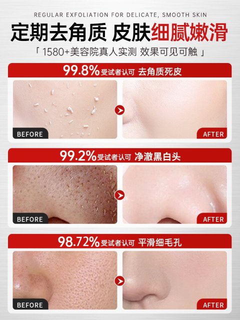 RENHEJIANGXIN | เจลลอกออกทำความสะอาดรูขุมขนอย่างล้ำลึก Image2