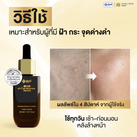 Yanhee Anti Melasma Serum ยันฮี เมลาสม่า เซรั่ม ลด ฝ้าแดด กระ จุดด่างดำ สูตรอ่อนโยน Image5
