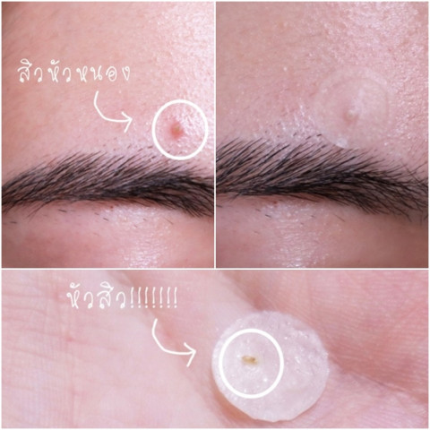 🚩โฉมใหม่! dermaAngel Mix size for Day 24 ชิ้น 4 กล่อง Image5