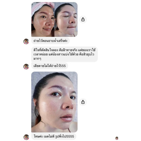 HOT ส่งฟรี [BUY 5 GET 5] Hayeon Cream ครีมโสมเกาหลี ฝ้า กระ ครีมทาฝ้า Image4