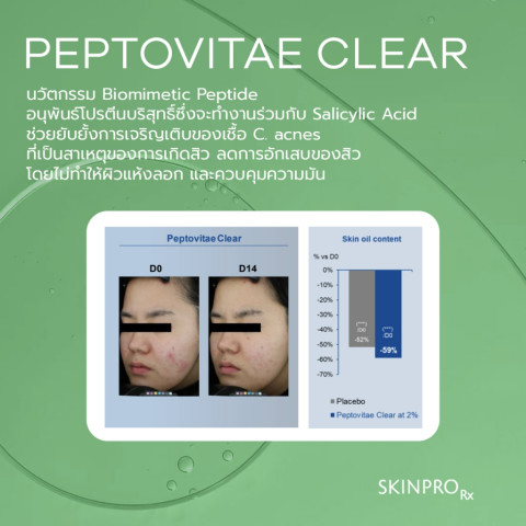 SKINPRO Rx Acne X Toner โทนเนอร์ลดสิว ลดความมัน กระชับรูขุมขน ปรับผิวใส ไม่อุดตัน 150 ml. จำนวน 1 ชิ้น* Image5