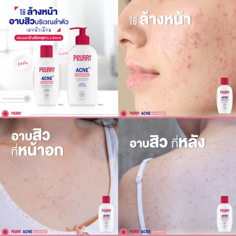 [สินค้าขายดี] PEURRi By Puricas  Acne Cleanser 500ml เจลล้างหน้าลดสิว  รับฟรี Anti Acne Gel เจลแต้มสิว 8g Image2