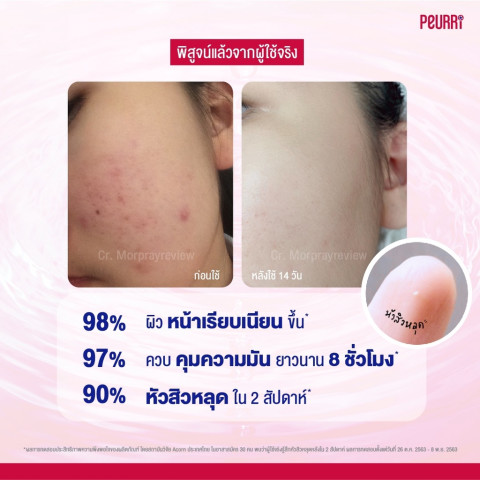 [สินค้าขายดี] PEURRi By Puricas  Acne Cleanser 500ml เจลล้างหน้าลดสิว  รับฟรี Anti Acne Gel เจลแต้มสิว 8g Image5