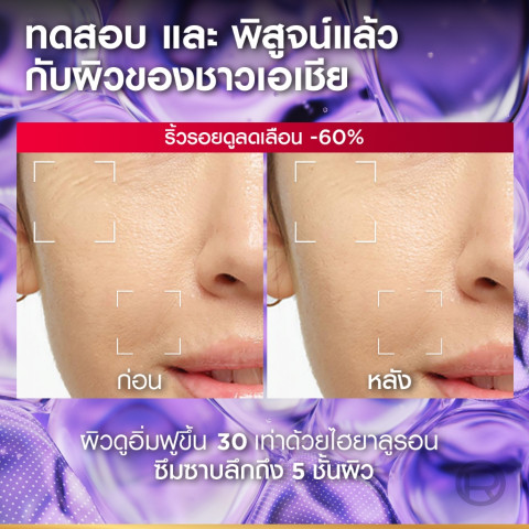 [แพ็กคู่] ลอรีอัล ปารีส L'Oréal Paris Revitalift Hyaluronic Acid Replumping Serum 30ml เซรั่มไฮยาเติมความชุ่มชื้น Image4