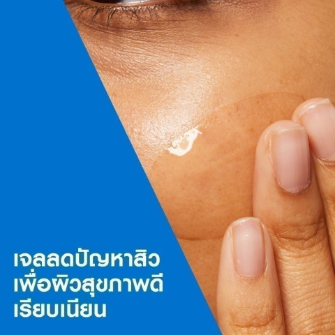 เซราวี CERAVE BLEMISH CONTROL GEL ผลิตภัณฑ์บำรุงผิวหน้า สูตรสำหรับผิวเป็นสิวง่าย 40 มล. Image4
