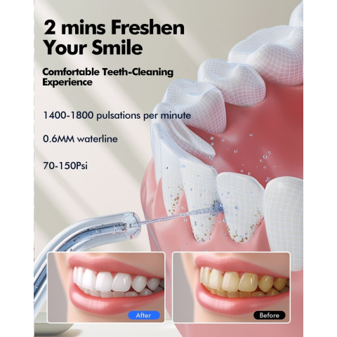 【COD】จัดส่ง 24 ชั่วโมง Bezvoi Y215 Water Flosser 300ML & จอแสดงผล LED ไหมขัดฟันทันตกรรมสําหรับวงเล็บเหงือกอ่อนไหวแบบพกพาทําความสะอาดฟัน กำจัดคราบหินปูน Oral Irrigation ทันตกรรม Cavity Care Image3