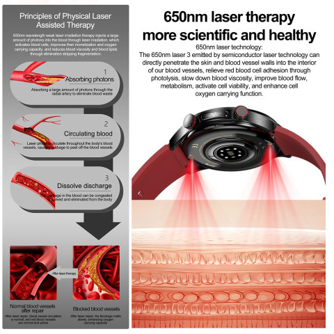 NineWind สมาร์ทวอท์ช E800ใหม่หัววัดคู่เลเซอร์ฟังก์ชั่นการรักษาสุขภาพ ECG Function กรดยูริคน้ำตาลในเลือดการวัดความดันโลหิตการตรวจสอบไขมันในเลือด AMOLED Screen นาฬิกากีฬาโทรผ่านบลูทูธ Image3