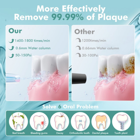 【จัดส่ง 24 ชั่วโมง】เครื่องชลประทานช่องปากแบบพกพามินิ การแก้ไขทันตกรรม Bezvoi Water Flosser (5 โหมด+6 หัวฉีด) พกพาง่าย ถอดล้างสะอาด เครื่องY207 สีเขียว Irrigator ปาก น้ําทําความสะอาดฟัน 300ML ถังน้ํา/Braces ทําความสะอาด สำหรับการทำความสะอาดฟ Image5