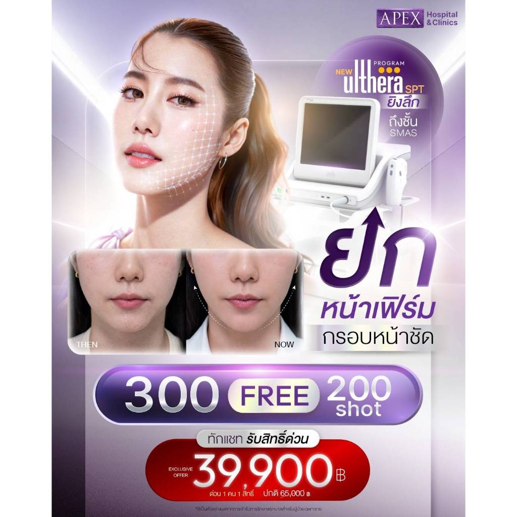 [E-Voucher] APEX ยกกระชับหน้า Ulthera spt 300 แถมฟรี 200 shot ได้ 500 shot ราคา 39,900 ปกติ 59,000 1ท่าน1สิทธิ | Shopee Thailand