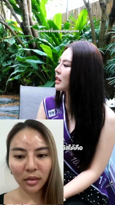 Y8 Bio Youth Sunscreen & Lumitech Up Moist Super Brightening Serum ครีมกันแดด+เซรั่มผิวใส ส่งฟรี | Lazada Thailand